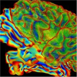 Whole brain for imaging research