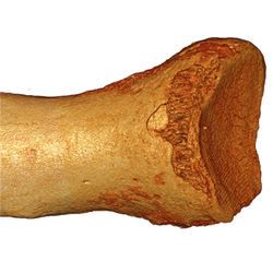 Neanderthal toe-bone