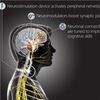 DARPA Wants to Hack Your Brain