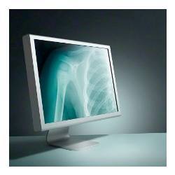 A medical x-ray.