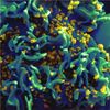 Hiv Overcomes Crispr Gene-Editing Attack