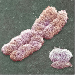 X and Y chromosomes