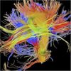 Brain Cartography: Modern-Day Explorers Are Mapping the Wiring of the Human Mind