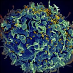 HIV-infected T cell