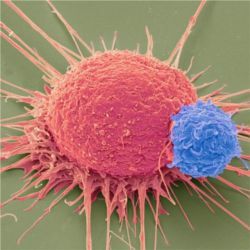 Human T cells (blue), cancer cells (pink)