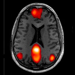 fMRI