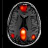 Software For Fmri Yield Erroneous Results