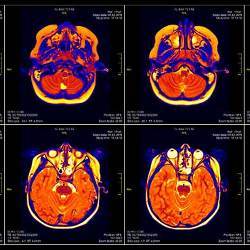 Functional magnetic resonance imaging scans of the human brain.