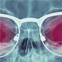 X-ray specs