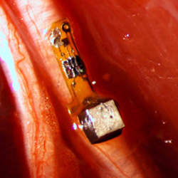 The sensor attached to a nerve fiber in a rat.