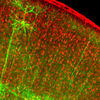 New Brain-Mapping Technique Captures Every Connection Between Neurons