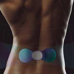 A transcutaneous electrical nerve stimulator in use.