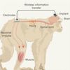 Brain Implants Allow Paralysed Monkeys to Walk