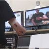 Augmented Reality Helps Patients With Chronic Phantom Limb Pain