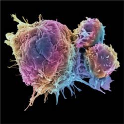 T cells (right) vs cancerous tumors (left)