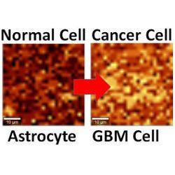 normal and cancerous brain cells under Raman imaging