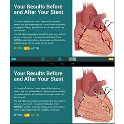 Screengrab of demo before (above) and after (below) heart health information from a tablet application.