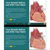 App Improves Medication Adherence For Heart Stent Patients