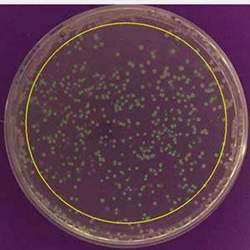 Bacterial colonies on a culture plate.
