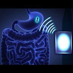 By using midfield transmission,researchers at Stanford University were able to deliver 100 to 200 microwatts of power to an ingested device.