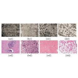 Sample optical coherence microscopy images (first row) and corresponding histology images (second row) of human breast tissue