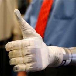 Modular prosthetic-arm technology