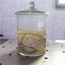 Human brain in jar