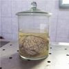 ­.s. Spends $65 Million to Build Brain Implants