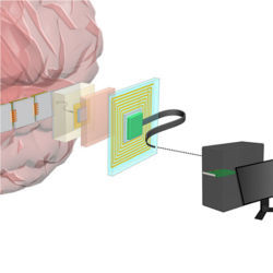 Brain-computer interface