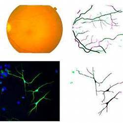 Retinal and neuronal segmentation images (right column) can be produced from empirical two-dimensional datasets (left column) thanks to a new computational approach.