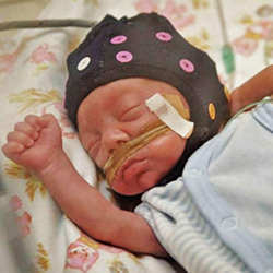A preterm infant receiving an electroencephalogram.