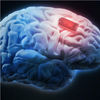 Q&a: The Ethics of ­sing Brain Implants to ­pgrade Yourself