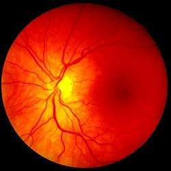 Photo of a retina.