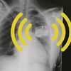 My Pacemaker Is Tracking Me from Inside My Body