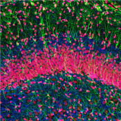 Nerve cells in hippocampus