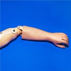 Prosthetic arm