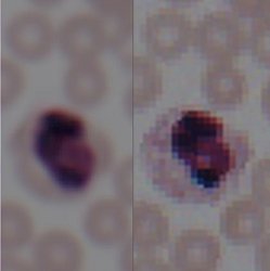 Image of a blood smear from a cellphone camera following enhancement by the algorithm (left), and an image taken by a lab microscope (right).