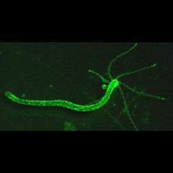 The hydra's neurons are labeled with a green fluorescence indicator.