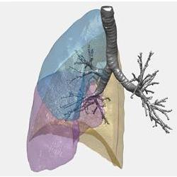 An illustration of lung structure based on computed tomography scan data.