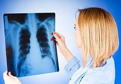 A doctor examines a lung x-ray.