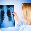 Big Data Tool Predicts Best Lung Cancer Treatment