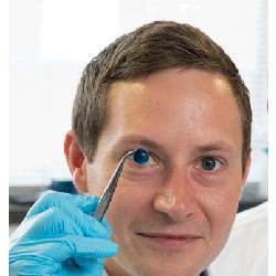 Newcastle University professor Che Connon shows a printed cornea.