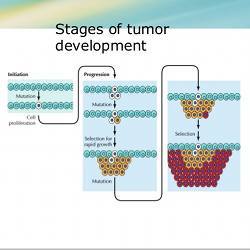 Stages of tumor development.