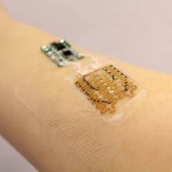 A smart bandage incorporates a wound-covering component (right), and a microprocessor (left) that interprets sensor input and triggers drug delivery. 