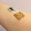 Smart Bandages Designed to Monitor and Tailor Treatment for Chronic Wounds