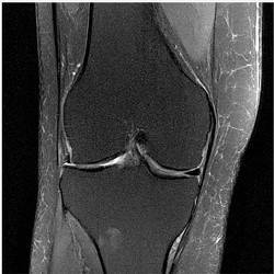 An enhanced magnetic resonance image, via fastMRI.