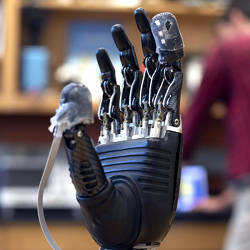 A prosthetic hand equipped with e-dermis on the thumb and forefinger.