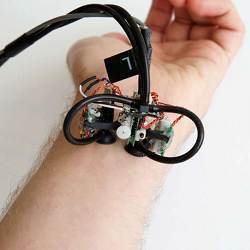 SkinBot inspects a wrist.