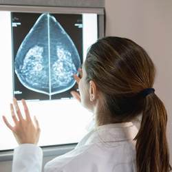 The automated deep-learning model identifies dense breast tissue in mammograms as reliably as expert radiologists.