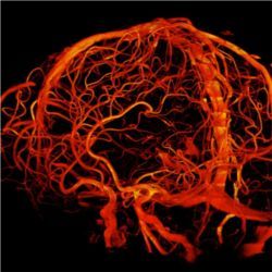 Cerebral blood vessels